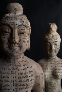 Acupuncture for Pain